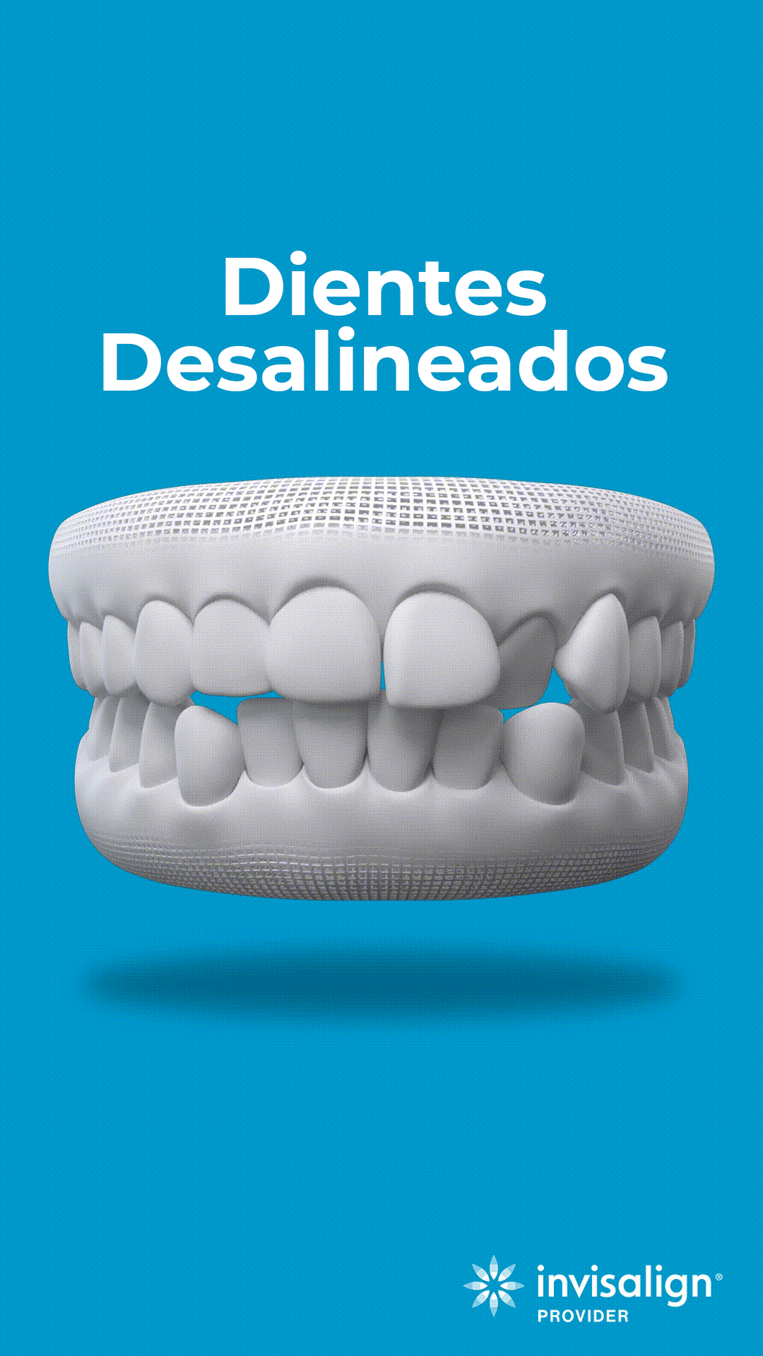 Diente-desalineado