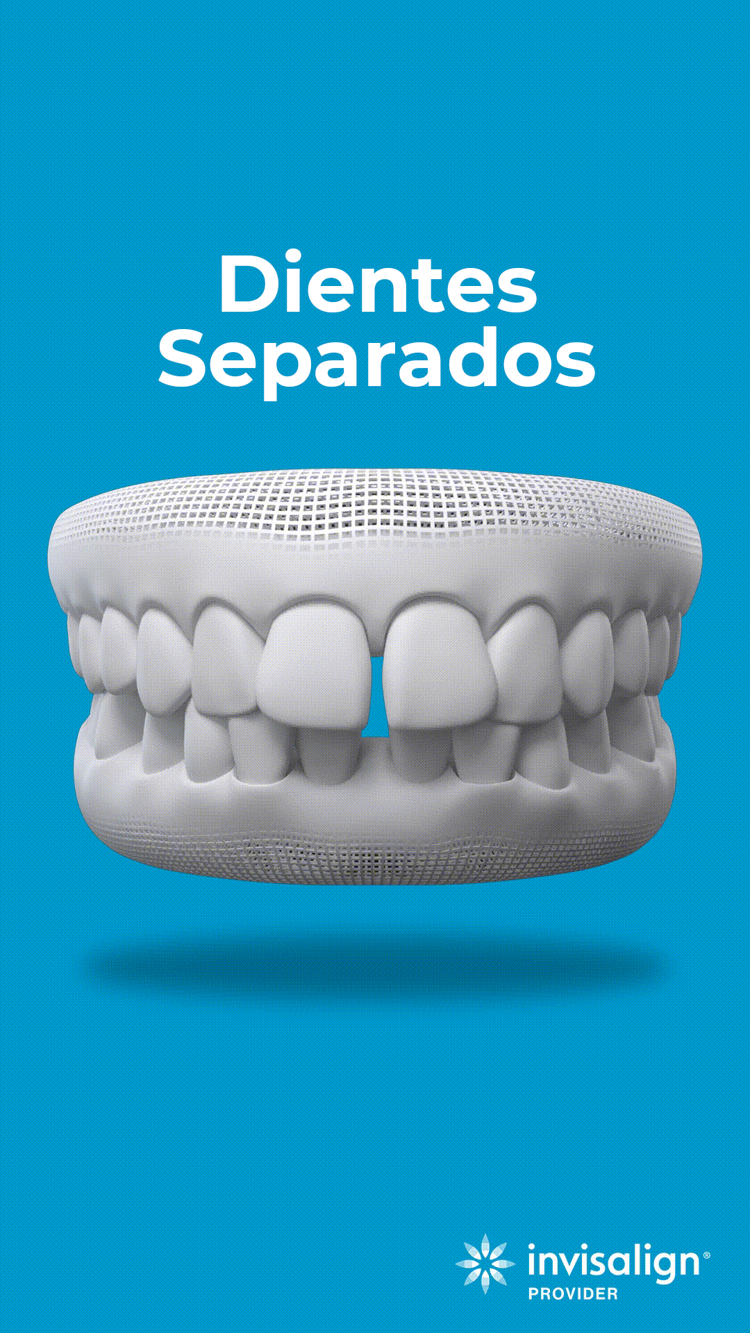 Dientes-separados