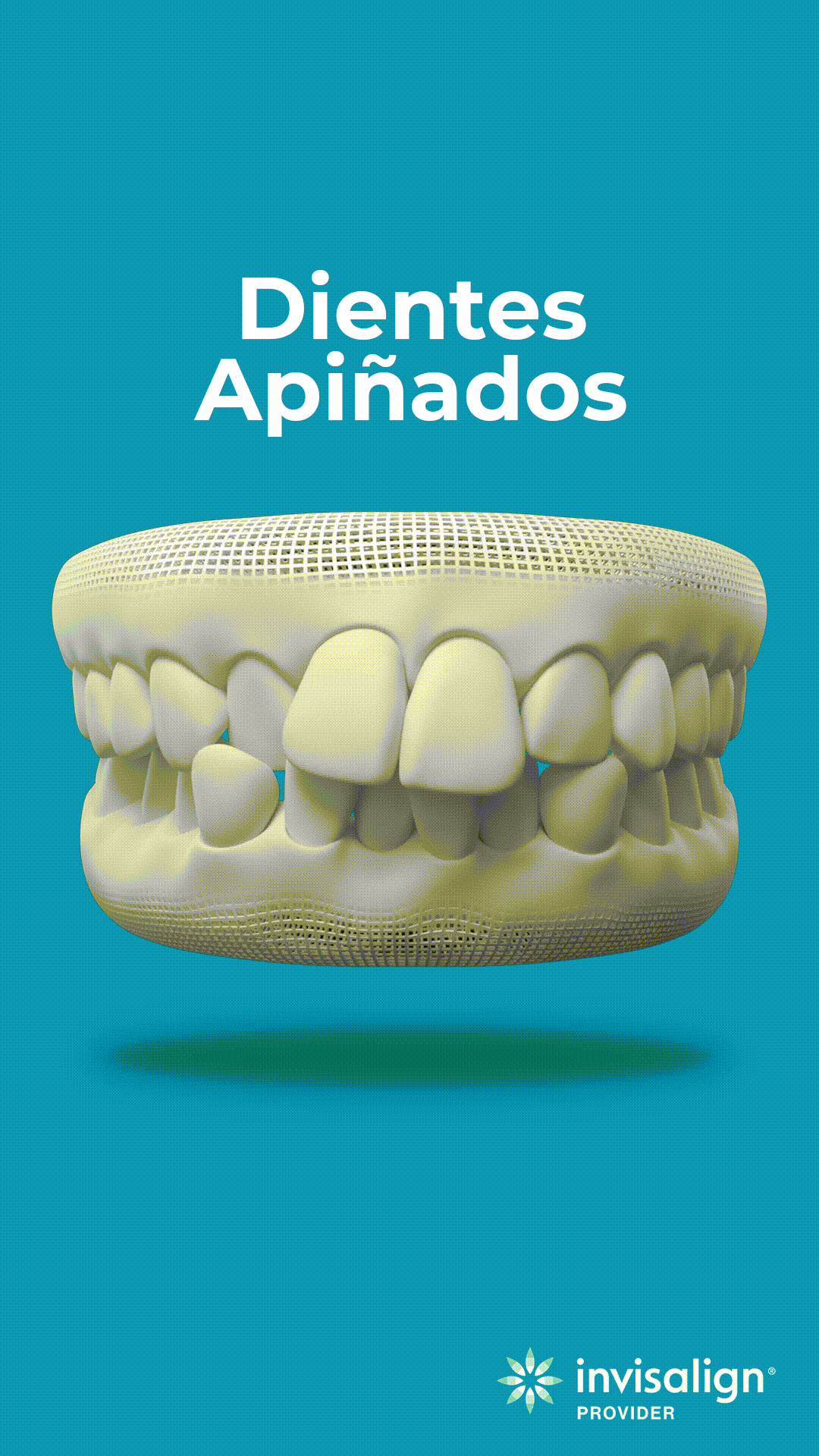dientes-apinados-1