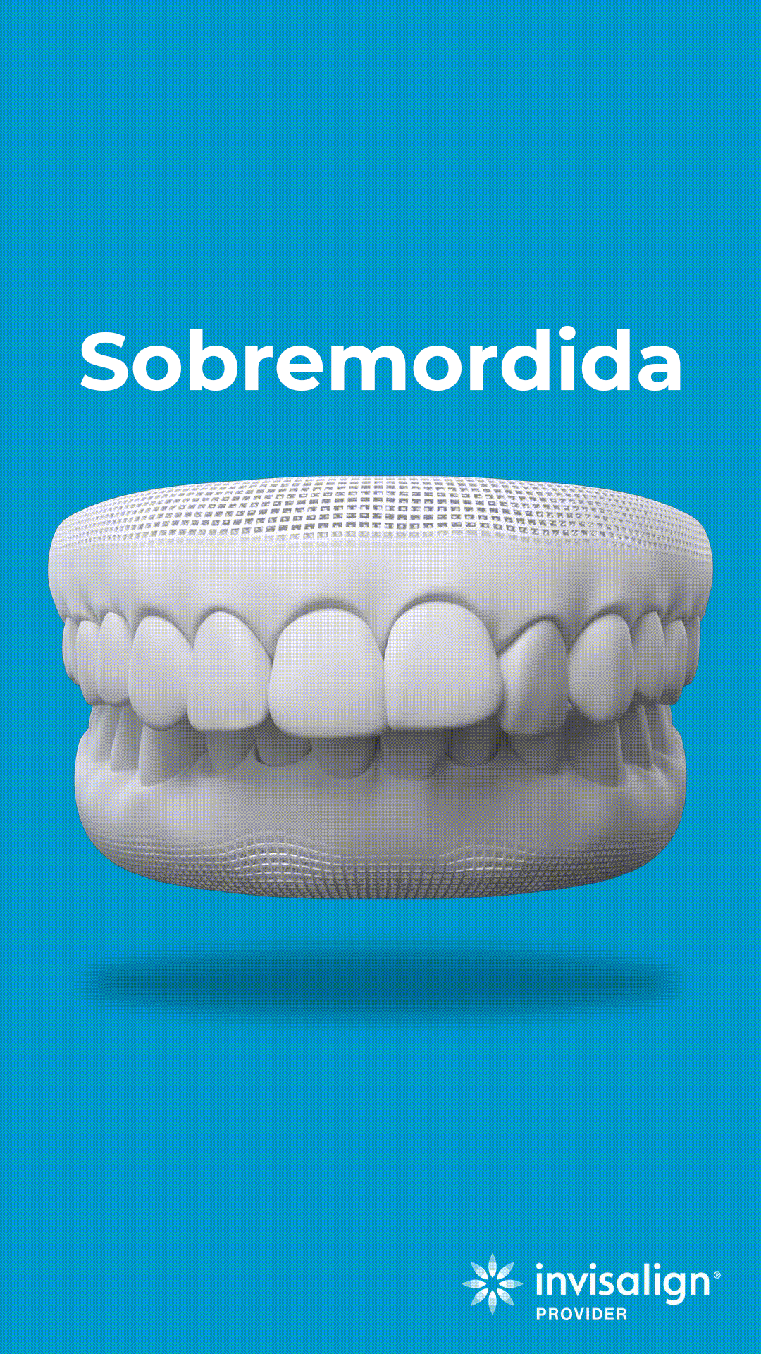 sobremordida-2